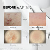 Reedle Shot 300 (50ml)