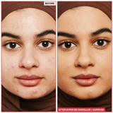 Super BB Concealer (10ml) - 5 shades